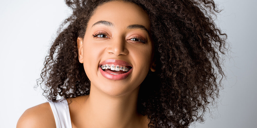 Dental Braces Brampton