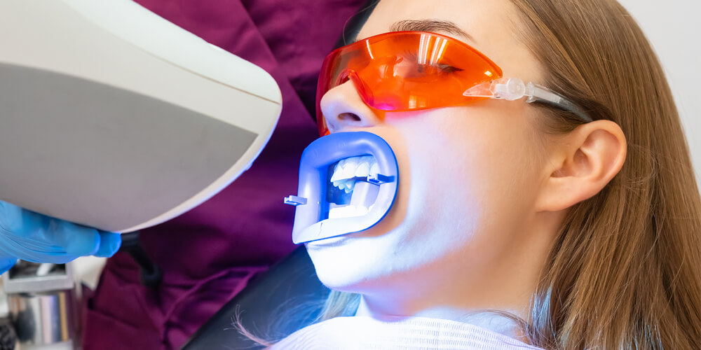 Teeth Whitening Brampton