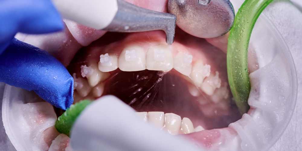 What Exactly Is Biofilm?
