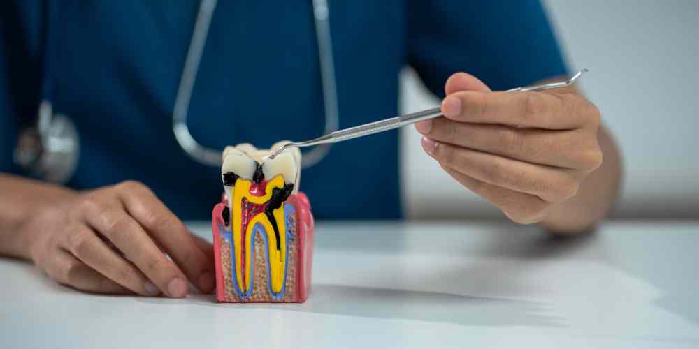 Root Canals Don’t Have to Be Scary: What Really Happens Root Canals Don’t Have to Be Scary: What Really Happens