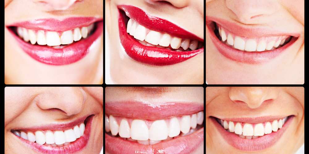 Why Teeth Whitening Causes Sensitivity Why Teeth Whitening Causes Sensitivity