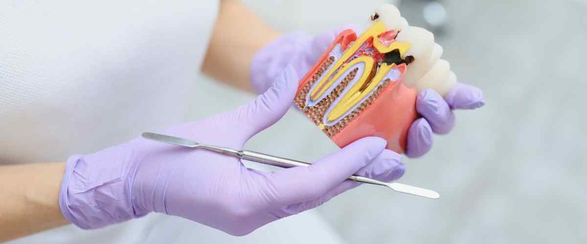 Stop Cavities Before They Start: Tips from Braydon Dental Care in Brampton